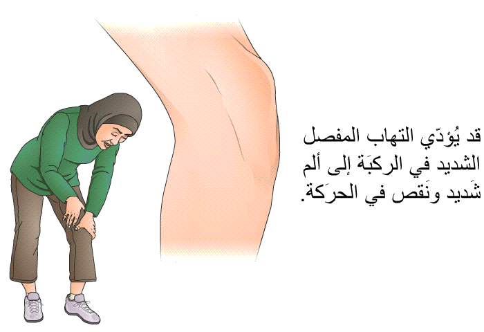 قد يُؤدّي التهاب المفصل الشديد في الركبَة إلى ألم شَديد ونَقص في الحرَكة.