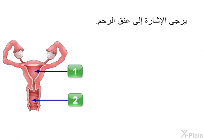 يرجى الإشارة إلى عنق الرحم.