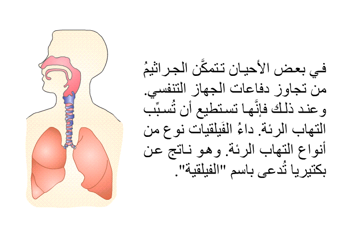 في بعض الأحيان تتمكَّن الجراثيمُ من تجاوز دفاعات الجهاز التنفسي. وعند ذلك فإنَّها تستطيع أن تُسبِّب التهاب الرئة. داءُ الفَيلقيات نوع من أنواع التهاب الرئة. وهو ناتج عن بكتيريا تُدعى باسم "الفيلقية".
