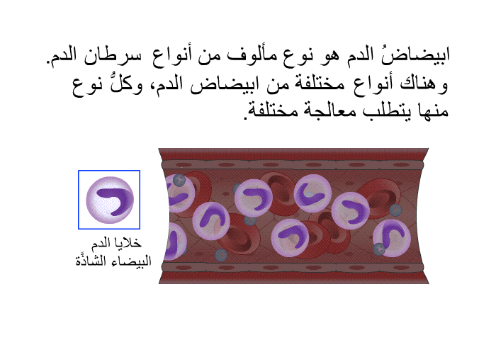 ابيضاضُ الدم هو نوع مألوف من أنواع سرطان الدم. وهناك أنواع مختلفة من ابيضاض الدم، وكلُّ نوع منها يتطلَّب معالجة مختلفة.