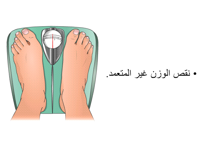 نقص الوزن غير المتعمد.
