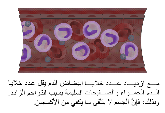 مع ازدياد عدد خلايا ابيضاض الدم يقل عدد خلايا الدم الحمراء والصفيحات السليمة بسبب التزاحم الزائد. وبذلك، فإنَّ الجسم لا يتلقَّى ما يكفي من الأكسجين.