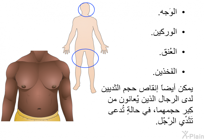 الوَجه.  الوركين.  العُنق.  الفَخذين.  
 يمكن أيضاً إنقاص حجم الثديين لدى الرِجال الذين يُعانون من كِبر حَجمهما، في حالةٍ تُدعى تَثَدِّي الرَّجُل.