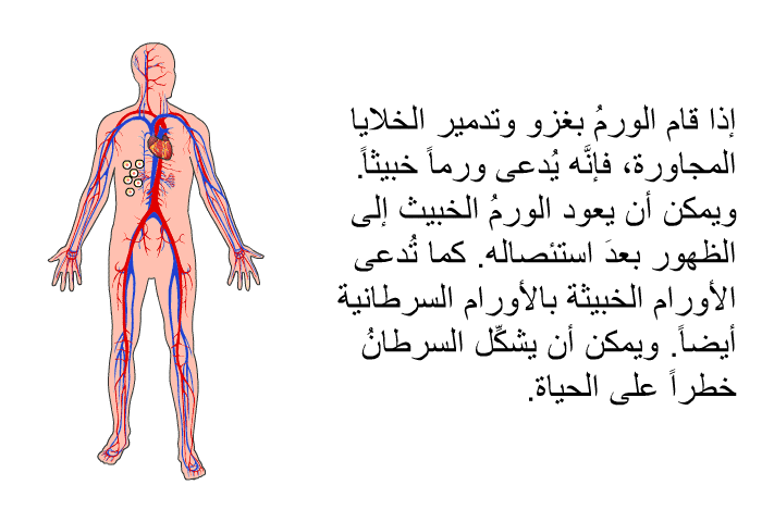 إذا قام الورمُ بغزو وتدمير الخلايا المجاورة، فإنَّه يُدعى ورماً خبيثاً. ويمكن أن يعود الورمُ الخبيث إلى الظهور بعدَ استئصاله. كما تُدعى الأورام الخبيثة بالأورام السرطانية أيضاً. ويمكن أن يشكِّل السرطانُ خطراً على الحياة.