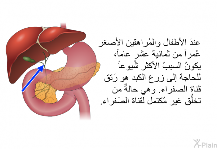 عندَ الأطفال والمُراهقين الأصغر عُمراً من ثمانية عشر عاماً، يكونُ السببُ الأكثر شُيوعاً للحاجة إلى زرع الكبد هو رَتق قَناة الصفراء. وهي حالةٌ من تخلُّق غير مُكتمل لقناة الصَفراء.