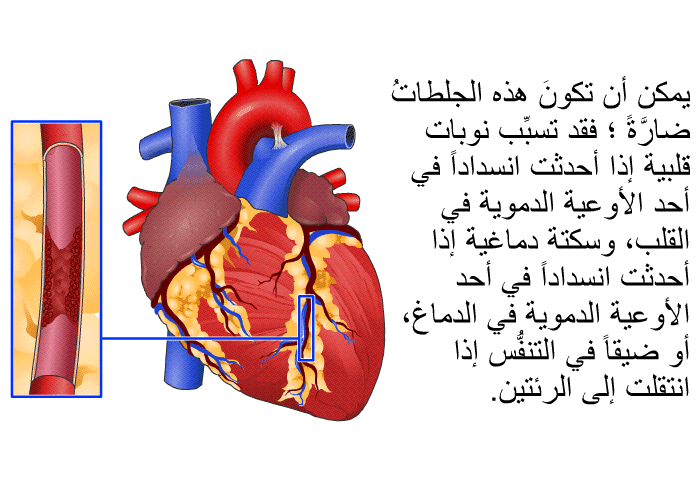 يمكن أن تكونَ هذه الجلطاتُ ضارَّةً؛ فقد تسبِّب نوبات قلبية إذا أحدثت انسداداً في أحد الأوعية الدموية في القلب، وسكتة دماغية إذا أحدثت انسداداً في أحد الأوعية الدموية في الدماغ، أو ضيقاً في التنفُّس إذا انتقلت إلى الرئتين.