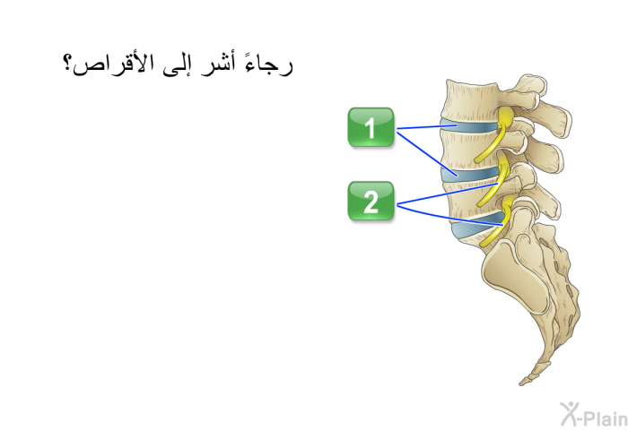 رجاءً أشر إلى الأقراص؟