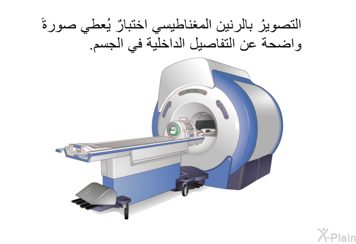 التصويرُ بالرنين المغناطيسي اختبارٌ يُعطي صورةً واضحة عن التفاصيل الداخلية في الجسم.