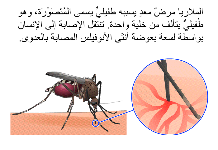 الملاريا مرضٌ معدٍ يسببه طفيليٌّ يسمى المُتَصَوِّرَة، وهو طُفيليٌّ يتألف من خلية واحدة. تنتقل الإصابة إلى الإنسان بواسطة لسعة بعوضة أنثى الأنوفيلس المصابة بالعدوى.