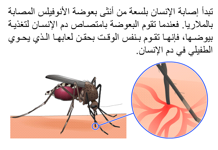 تبدأ إصابة الإنسان بلسعة من أنثى بعوضة الأنوفيلس المصابة بالملاريا. فعندما تقوم البعوضة بامتصاص دم الإنسان لتغذية بيوضها، فإنها تقوم بنفس الوقت بحقن لعابها الذي يحوي الطفيلي في دم الإنسان.