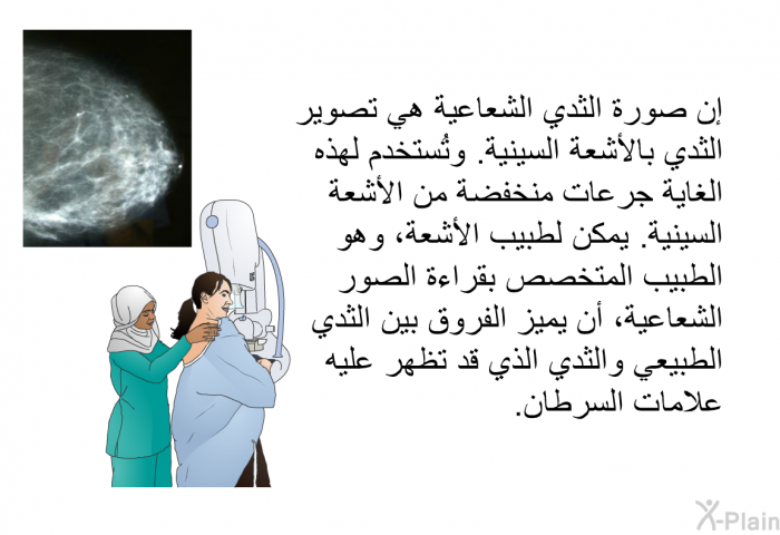 إن صورة الثدي الشعاعية هي تصوير الثدي بالأشعة السينية. وتُستخدم لهذه الغاية جرعات منخفضة من الأشعة السينية. يمكن لطبيب الأشعة، وهو الطبيب المتخصص بقراءة الصور الشعاعية، أن يميز الفروق بين الثدي الطبيعي والثدي الذي قد تظهر عليه علامات السرطان.