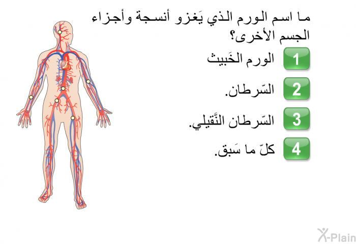 ما اسم الورم الذي يَغزو أنسجة وأجزاء الجسم الأخرى؟   الورم الخَبيث  السّرطان.  السّرطان النَّقيلي.  كلّ ما سَبق