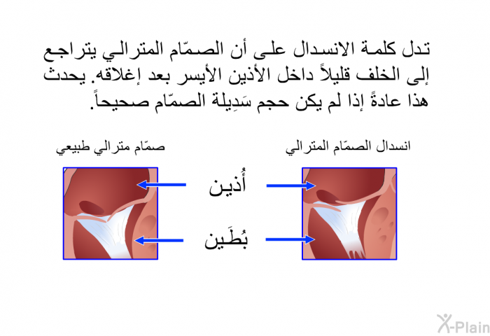 تدل كلمة الانسدال على أن الصمّام المترالي يتراجع إلى الخلف قليلاً داخل الأذين الأيسر بعد إغلاقه. يحدث هذا عادةً إذا لم يكن حجم سَدِيلة الصمّام صحيحاً.