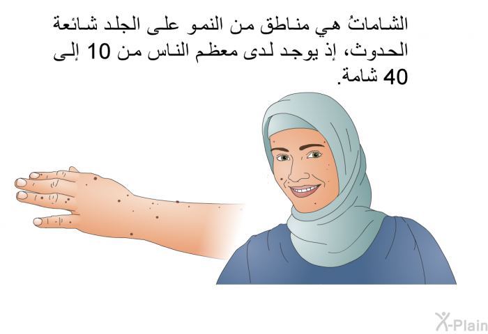 الشاماتُ هي مناطق من النمو على الجلد شائعة الحدوث، إذ يوجد لدى معظم الناس من 10 إلى 40 شامة.