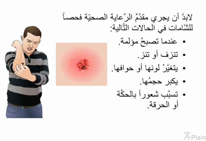 لابدَّ أن يجري مقدِّمُ الرِّعاية الصحيّة فحصاً للشَّامات في الحالات التَّالية:  عندما تصبحُ مؤلمة. تنزف أو تنز. يتغيَّرُ لونها أو حوافها. يكبر حجمُها. تسبِّب شعوراً بالحكَّة أو الحرقة.