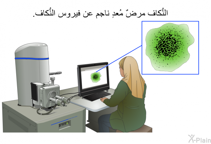 النُّكاف مرضٌ مُعدٍ ناجم عن فيروس النُّكاف.