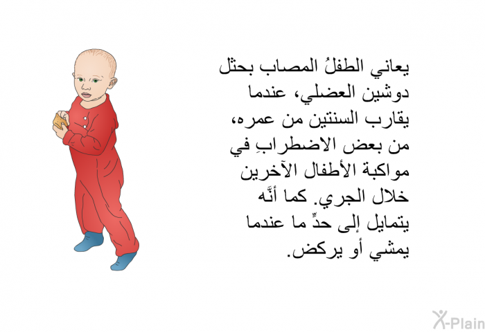 يعاني الطفلُ المصاب بحثل دوشين العضلي، عندما يقارب السنتين من عمره، من بعض الاضطرابِ في مواكبة الأطفال الآخرين خلال الجري. كما أنَّه يتمايل إلى حدٍّ ما عندما يمشي أو يركض.