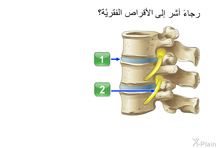 رجاءً أشر إلى الأقراص الفقريَّة؟