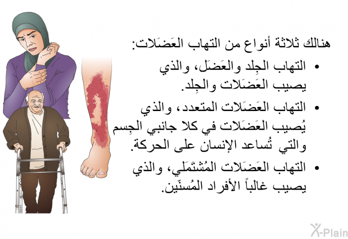 هنالك ثلاثة أنواع من التهاب العَضَلات:   التهاب الجِلد والعَضَل، والذي يصيب العَضَلات والجِلد.  التهاب العَضَلات المتعدد ، والذي يُصيب العَضَلات في كلا جانبي الجِسم والتي تُساعد الإنسان على الحركة. التهاب العَضَلات المُشتَمَلي، والذي يصيب غالباً الأفراد المُسنّين.