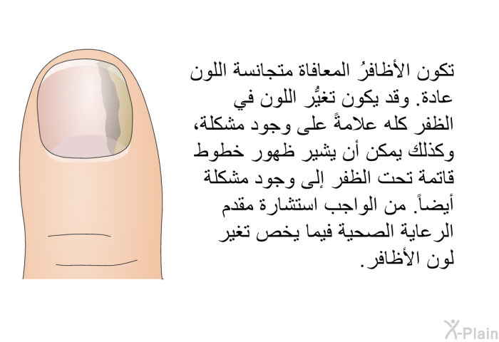 تكون الأظافرُ المعافاة متجانسة اللون عادة. وقد يكون تغيُّر اللون في الظفر كله علامةً على وجود مشكلة، وكذلك يمكن أن يشير ظهور خطوط قاتمة تحت الظفر إلى وجود مشكلة أيضاً. من الواجب استشارة مقدم الرعاية الصحية فيما يخص تغير لون الأظافر.