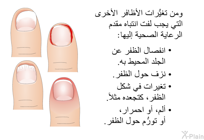 ومن تغيُّرات الأظافر الأخرى التي يجب لفت انتباه مقدم الرعاية الصحية إليها:   انفصال الظفر عن الجلد المحيط به.  نزف حول الظفر.  تغيرات في شكل الظفر، كتجعده مثلاً. ألم، أو احمرار، أو تورُّم حول الظفر.