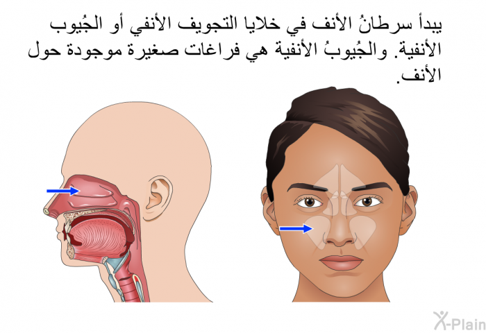 يبدأ سرطانُ الأنف في خلايا التجويف الأنفي أو الجُيوب الأنفية. والجُيوبُ الأنفية هي فراغات صغيرة موجودة حول الأنف.