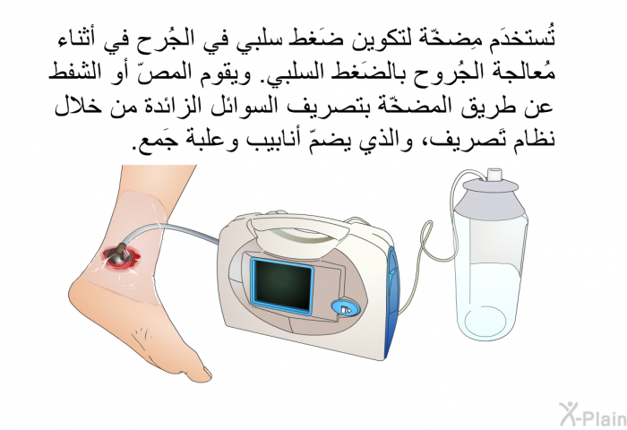 تُستخدَم مِضخّة لتكوين ضَغط سلبي في الجُرح في أثناء مُعالجة الجُروح بالضَغط السلبي. ويقوم المصّ أو الشفط عن طريق المضخّة بتصريف السوائل الزائدة من خلال نظام تَصريف، والذي يضمّ أنابيب وعلبة جَمع.