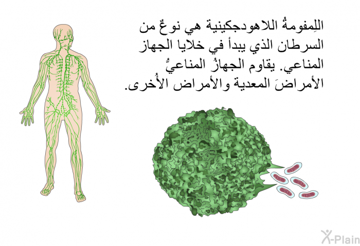 اللِمفومةُ اللاهودجكينية هي نوعٌ من السرطان الذي يبدأ في خلايا الجهاز المناعي. يقاوم الجهازُ المناعيُّ الأمراضَ المعدية والأمراض الأُخرى.