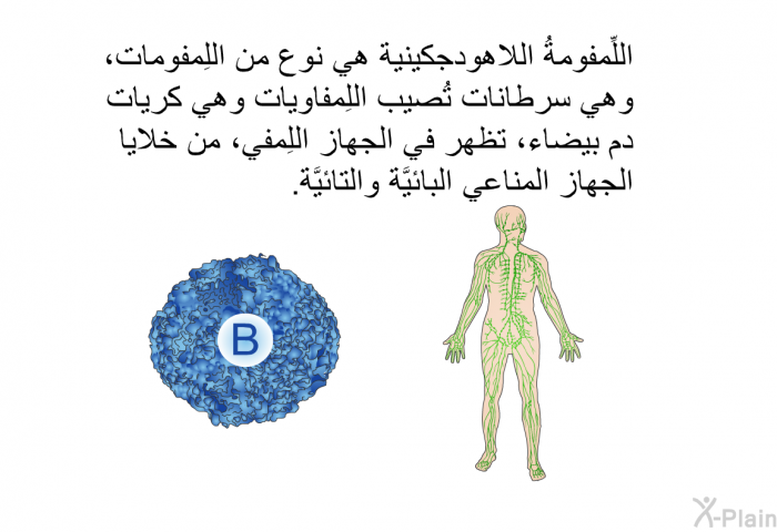 اللِّمفومةُ اللاهودجكينية هي نوع من اللِمفومات، وهي سرطانات تُصيب اللِمفاويات وهي كريات دم بيضاء، تظهر في الجهاز اللِمفي، من خلايا الجهاز المناعي البائيَّة والتائيَّة.