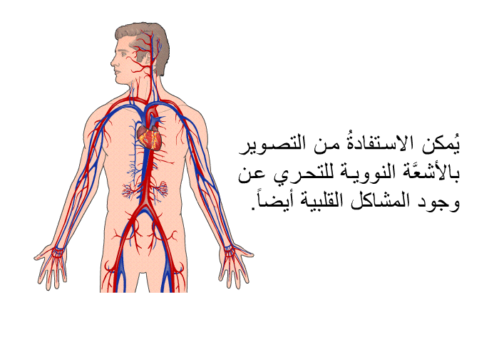 يُمكن الاستفادةُ من التصوير بالأشعَّة النووية للتحري عن وجود المشاكل القلبية أيضاً.