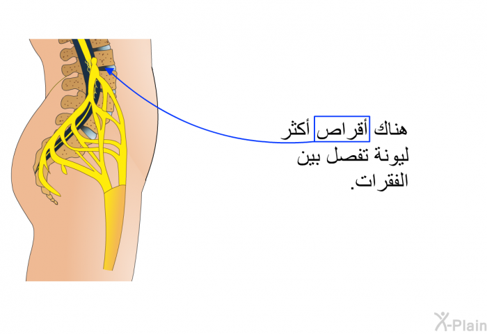 هناك أقراص أكثر ليونة تفصل بين الفقرات.