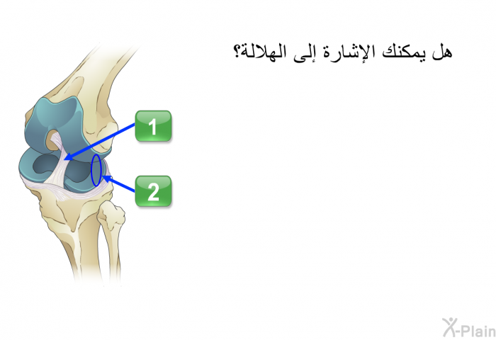 هل يمكنك الإشارة إلى الهلالة؟