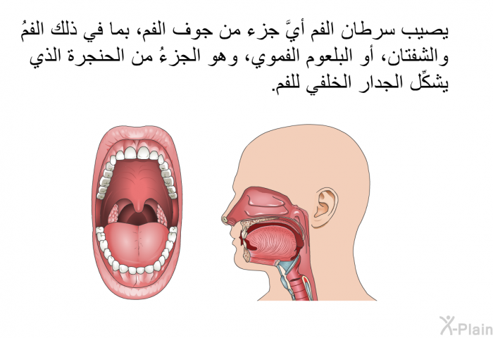 يصيب سرطان الفم أيَّ جزء من جوف الفم، بما في ذلك الفمُ والشفتان، أو البلعوم الفموي، وهو الجزءُ من الحنجرة الذي يشكِّل الجدار الخلفي للفم.