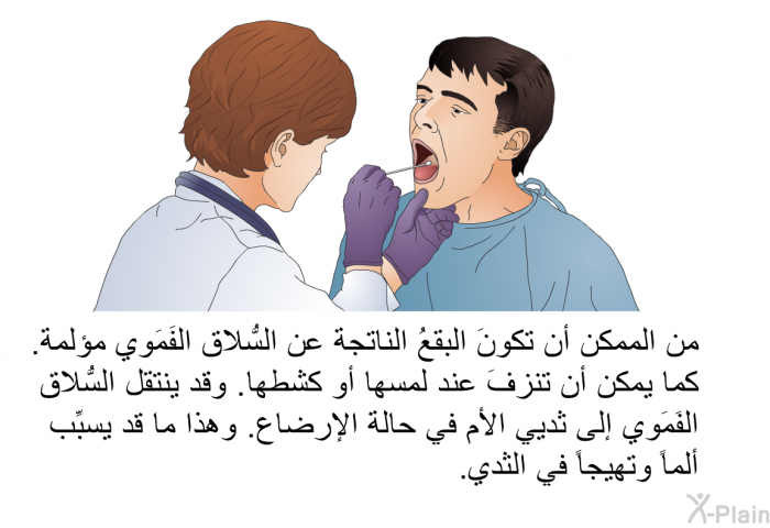 من الممكن أن تكونَ البقعُ الناتجة عن السُّلاق الفَمَوي مؤلمة. كما يمكن أن تنزفَ عند لمسها أو كشطها. وقد ينتقل السُّلاق الفَمَوي إلى ثديي الأم في حالة الإرضاع. وهذا ما قد يسبِّب ألماً وتهيجاً في الثدي.