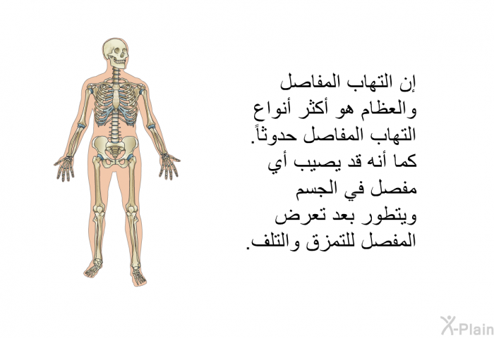 إن التهاب المفاصل والعظام هو أكثر أنواع التهاب المفاصل حدوثاً. كما أنه قد يصيب أي مفصل في الجسم ويتطور بعد تعرض المفصل للتمزق والتلف.