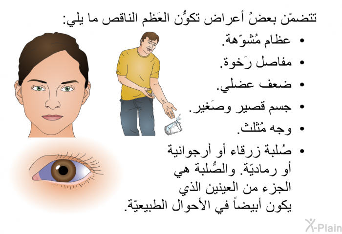 تتضمّن بعضُ أعراض تكوُّن العَظم الناقص ما يلي:  عظام مُشوّهة. مفاصل رَخوة. ضعف عضلي. جسم قصير وصَغير. وجه مُثلث. صُلبة زرقاء أو أرجوانية أو رماديّة. والصُّلبة هي الجزء من العينين الذي يكون أبيضاً في الأحوال الطبيعيّة.
