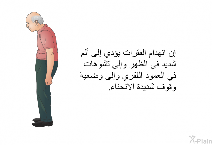 إن انهدام الفقرات يؤدي إلى ألم شديد في الظهر وإلى تشوهات في العمود الفقري وإلى وضعية وقوف شديدة الانحناء<B>. </B>