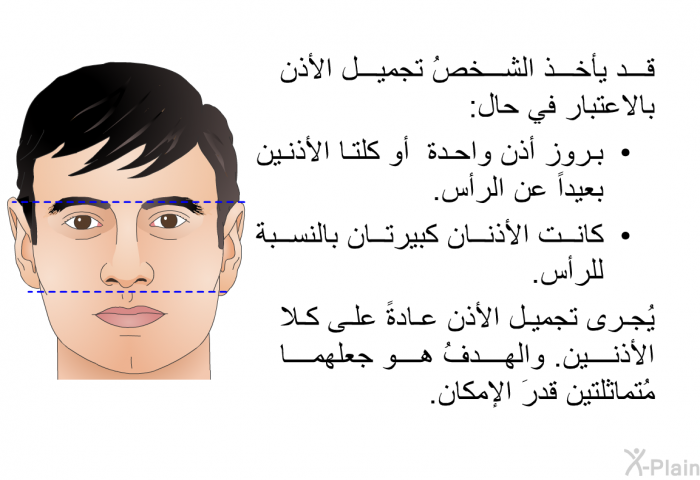 قد يأخذ الشخصُ تجميل الأذن بالاعتبار في حال:  بروز أذن واحدة أو كلتا الأذنين بعيداً عن الرأس. كانت الأذنان كبيرتان بالنسبة للرأس.

  يُجرى تجميل الأذن عادةً على كلا الأذنين. والهدفُ هو جعلهما مُتماثلتين قدرَ الإمكان.