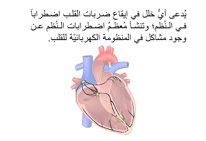 يُدعى أيُّ خلل في إيقاع ضربات القلب اضطراباً في النَّظم؛ وتنشأ مُعظمُ اضطرابات النَّظم عن وجود مشاكل في المنظومة الكهربائيَّة للقلب.