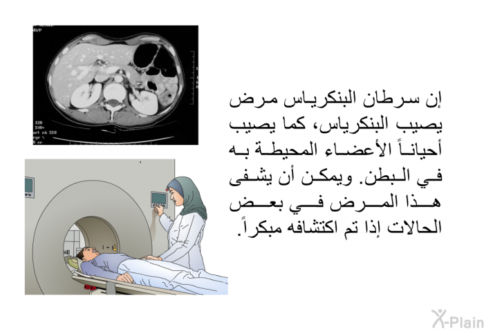 إن سرطان البنكرياس مرض يصيب البنكرياس، كما يصيب أحياناً الأعضاء المحيطة به في البطن. ويمكن أن يشفى هذا المرض في بعض الحالات إذا تم اكتشافه مبكراً.