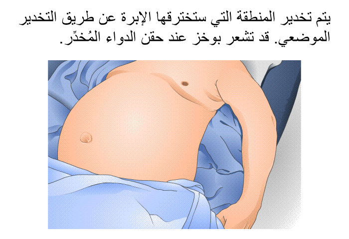 يتم تخدير المنطقة التي ستخترقها الإبرة عن طريق التخدير الموضعي. قد تشعر بوخز عند حقن الدواء المُخدِّر.
