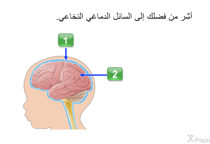 أشِر من فضلك إلى السائل الدماغي النخاعي.