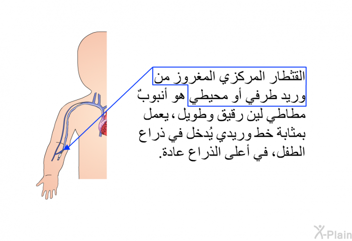 القثطار المركزي المغروز من وريد طرفي أو محيطي هو أنبوبٌ مطَّاطي لين رقيق وطويل، يعمل بمثابة خط وريدي يُدخل في ذراع الطفل، في أعلى الذراع عادة.