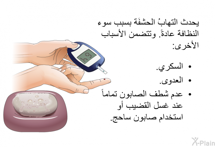 يحدثُ التهابُ الحشفَة بسبب سوء النظافة عادةً. وتتضمن الأسباب الأخرى:  السكري. العدوى. عدم شطف الصابون تماماً عند غسل القضيب أو استخدام صابون ساحج.