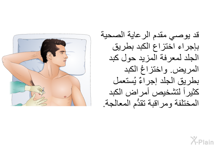 قد يوصي مقدم الرعاية الصحية بإجراء اختزاع الكبد بِطريق الجلد لمعرفة المزيد حول كبد المريض. واختزاعُ الكبد بِطريق الجلد إجراءٌ يُستعمل كثيراً لتشخيص أمراض الكبد المختلفة ومراقبة تقدُّم المعالجة.