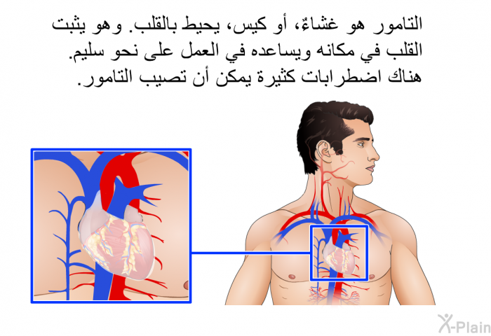 التامور هو غشاءٌ، أو كيس، يحيط بالقلب. وهو يثبت القلب في مكانه ويساعده في العمل على نحو سليم. هناك اضطرابات كثيرة يمكن أن تصيب التامور.