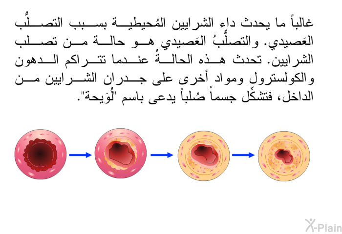 غالباً ما يحدث داء الشرايين المُحيطية بسبب التصلُّب العَصيدي. والتصلُّبُ العَصيدي هو حالة من تصلب الشرايين. تحدث هذه الحالةُ عندما تتراكم الدهون والكولسترول ومواد أخرى على جدران الشرايين من الداخل، فتشكِّل جسماً صُلباً يدعى باسم "لُوَيحة".