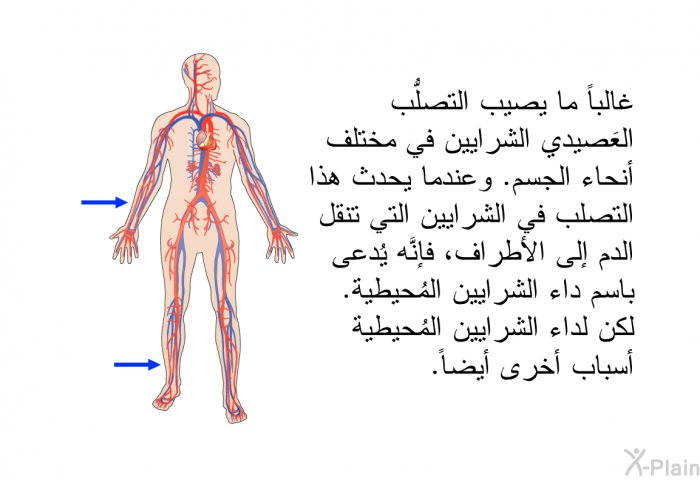 غالباً ما يصيب التصلُّب العَصيدي الشرايين في مختلف أنحاء الجسم. وعندما يحدث هذا التصلب في الشرايين التي تنقل الدم إلى الأطراف، فإنَّه يُدعى باسم داء الشرايين المُحيطية. لكن لداء الشرايين المُحيطية أسباب أخرى أيضاً.