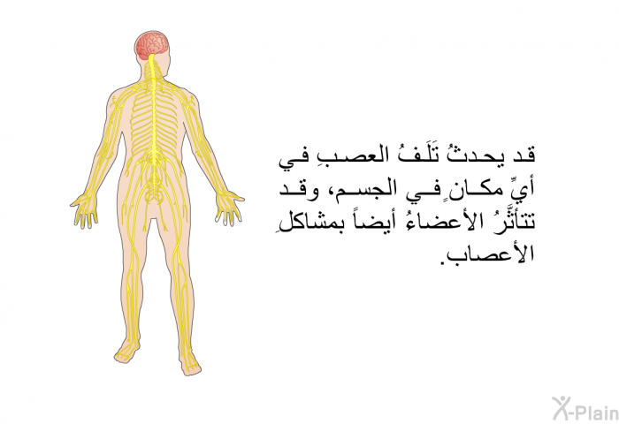 قد يحدثُ تَلَفُ العصبِ في أيِّ مكانٍ في الجسم، وقد تتأثَّرُ الأعضاءُ أيضاً بمشاكلِ الأعصاب.
