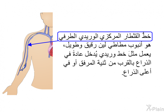 خطُّ القثطار المركزي الوريدي الطرفي هو أنبوب مطَّاطي لين رقيق وطويل، يعمل مثلَ خط وريدي يُدخل عادةً في الذراع بالقرب من ثنية المرفق أو في أعلى الذراع.